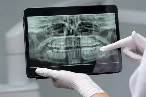 Digital X-Ray