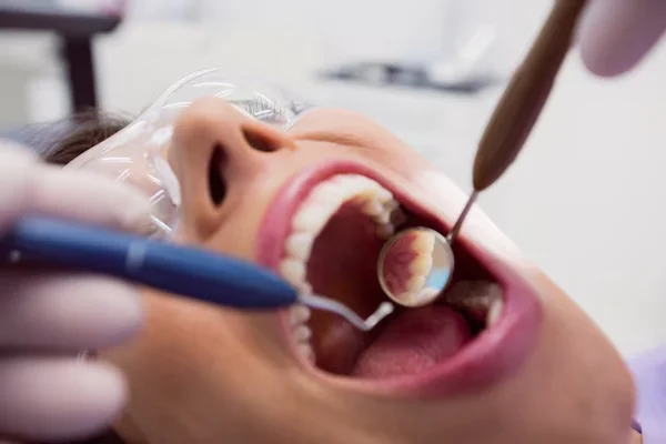 Tooth Coloured Filling